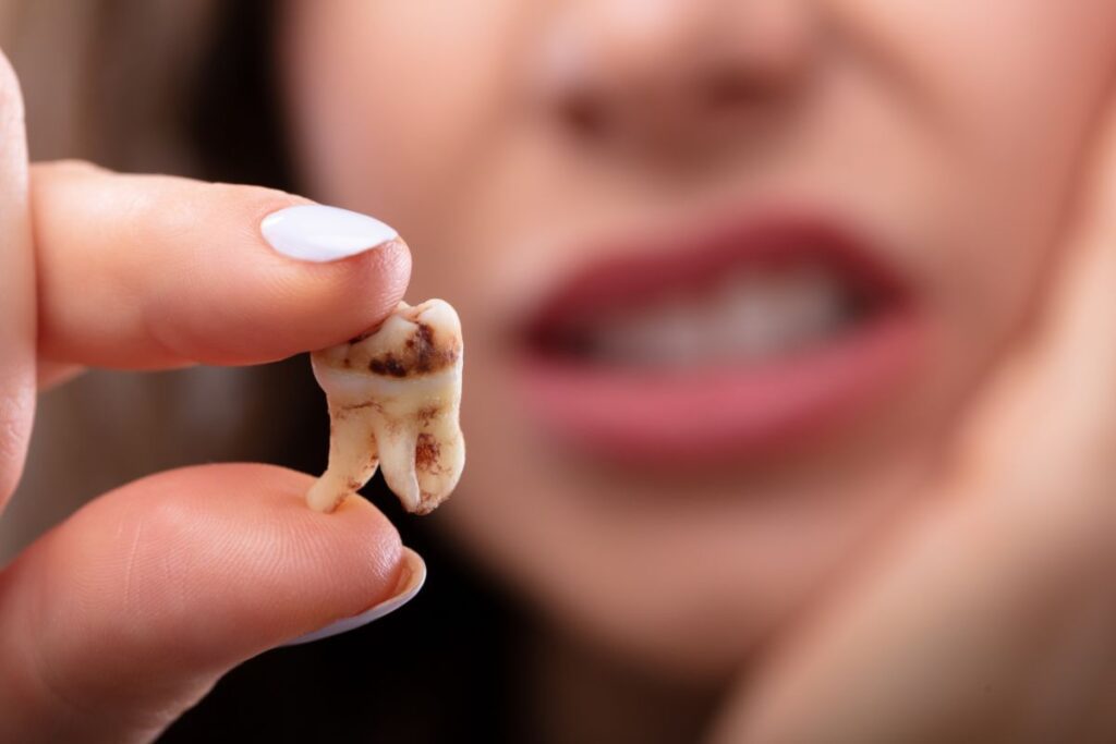 Suboxone tooth decay lawsuit