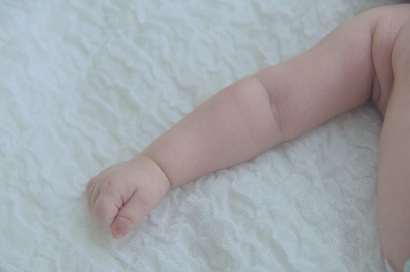 brachial plexus injury