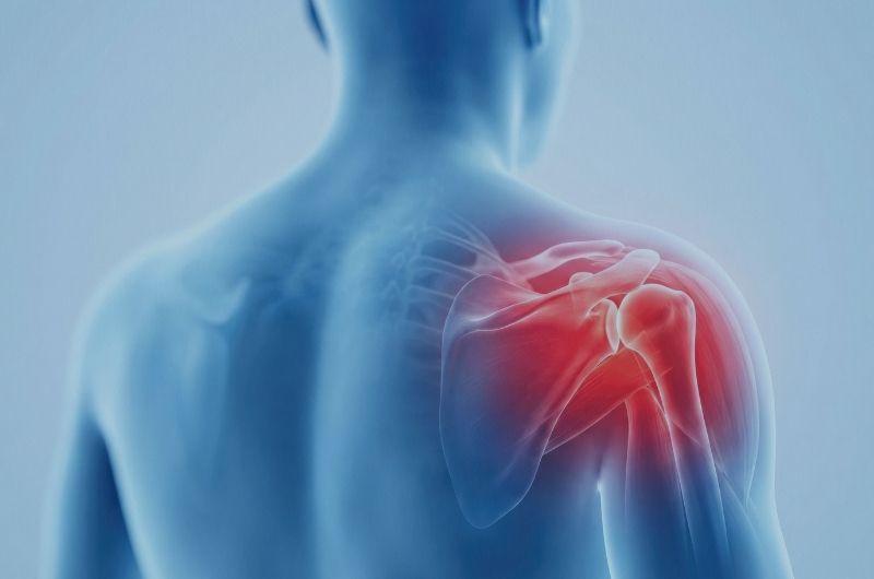 shoulder dystocia lawyer