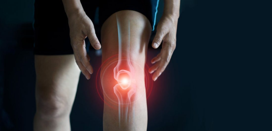 Elderly woman suffering from pain in knee. Tendon problems and J Image of a person with a knee injury